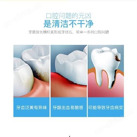 迪斯 电动牙刷 DE-D05 美泽无锡礼品定制 会员礼品加盟 MY-DSJK-L5-01